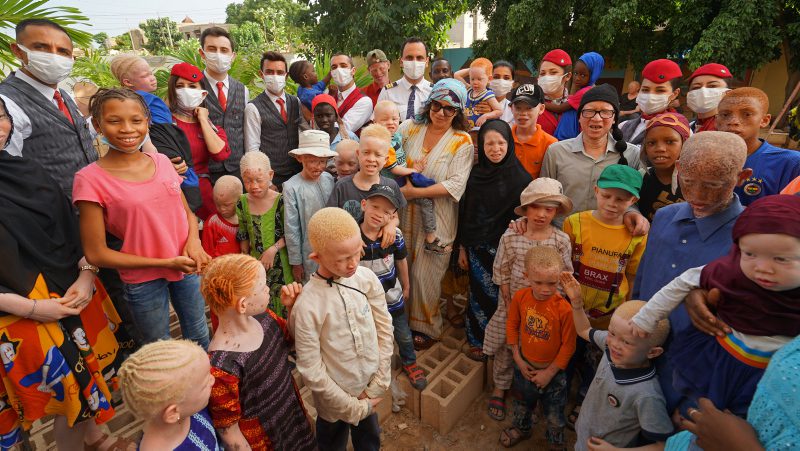 Ccharity group formed by Turkish Airlines employees help Senegal’s albino children