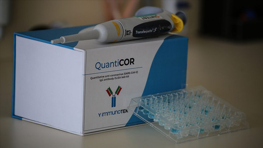 Scientists develop Turkey’s first locally-made antibody test kit
